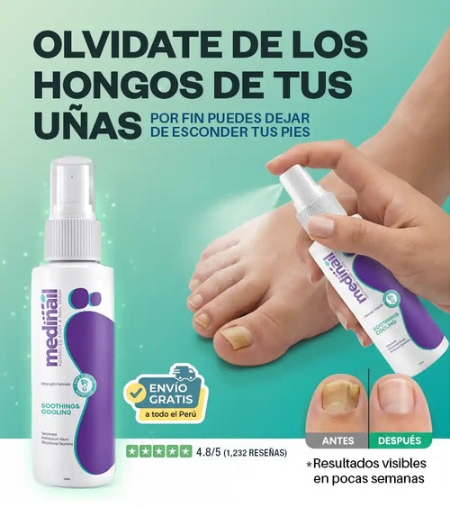 Medinail® Por fin puedes dejar de esconder tus pies