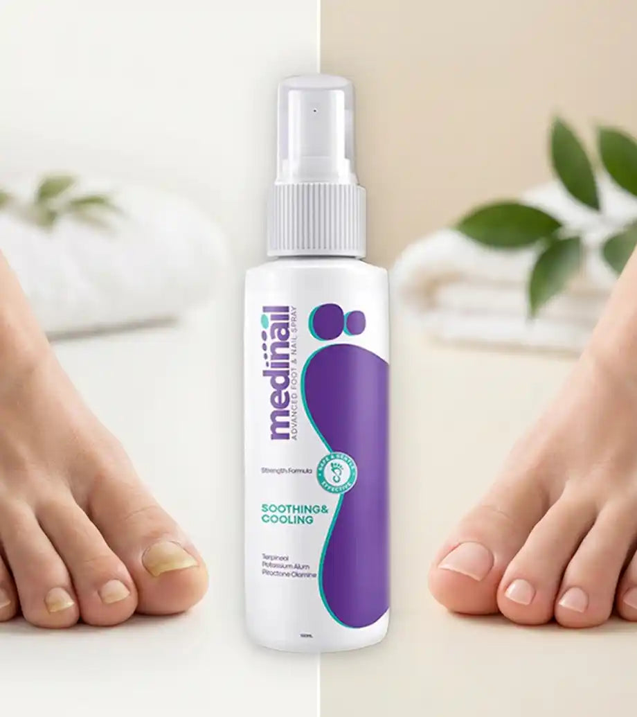 Medinail® Por fin puedes dejar de esconder tus pies