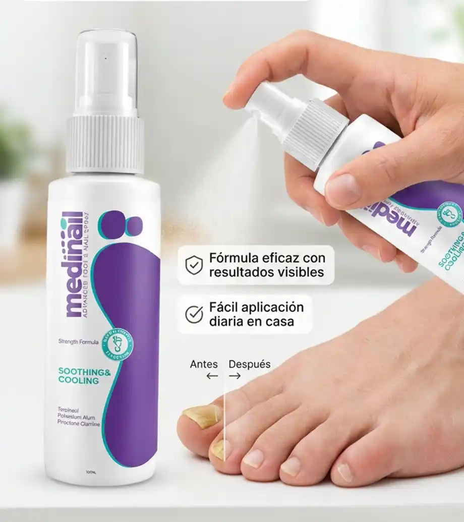 Medinail® Por fin puedes dejar de esconder tus pies